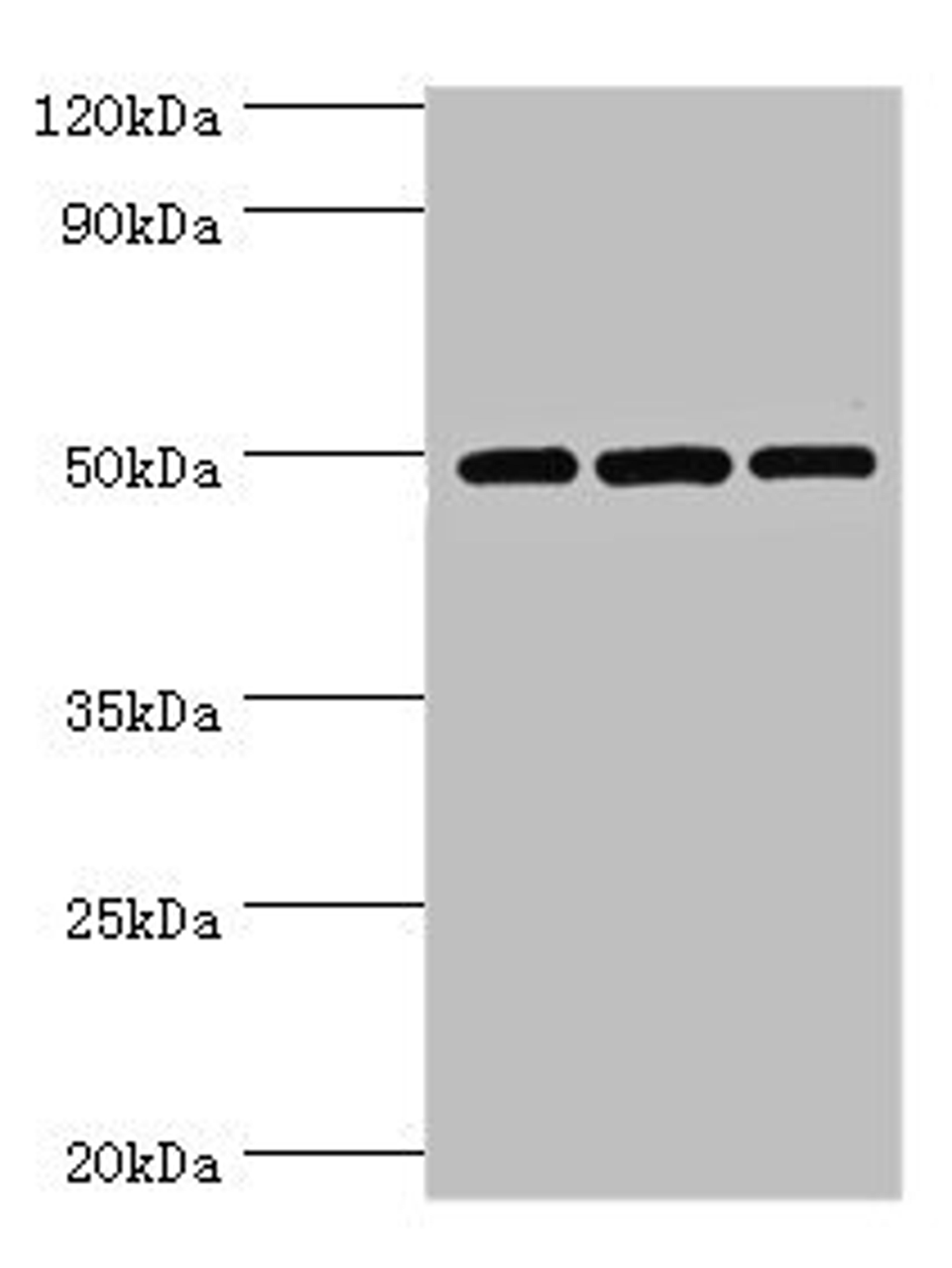 Western blot. All lanes: m7GpppN-mRNA hydrolase antibody at 7ug/ml. Lane 1: Hela whole cell lysate. Lane 2: Jurkat whole cell lysate. Lane 3: 293T whole cell lysate. Secondary. Goat polyclonal to rabbit IgG at 1/10000 dilution. Predicted band size: 49, 45 kDa. Observed band size: 49 kDa. 