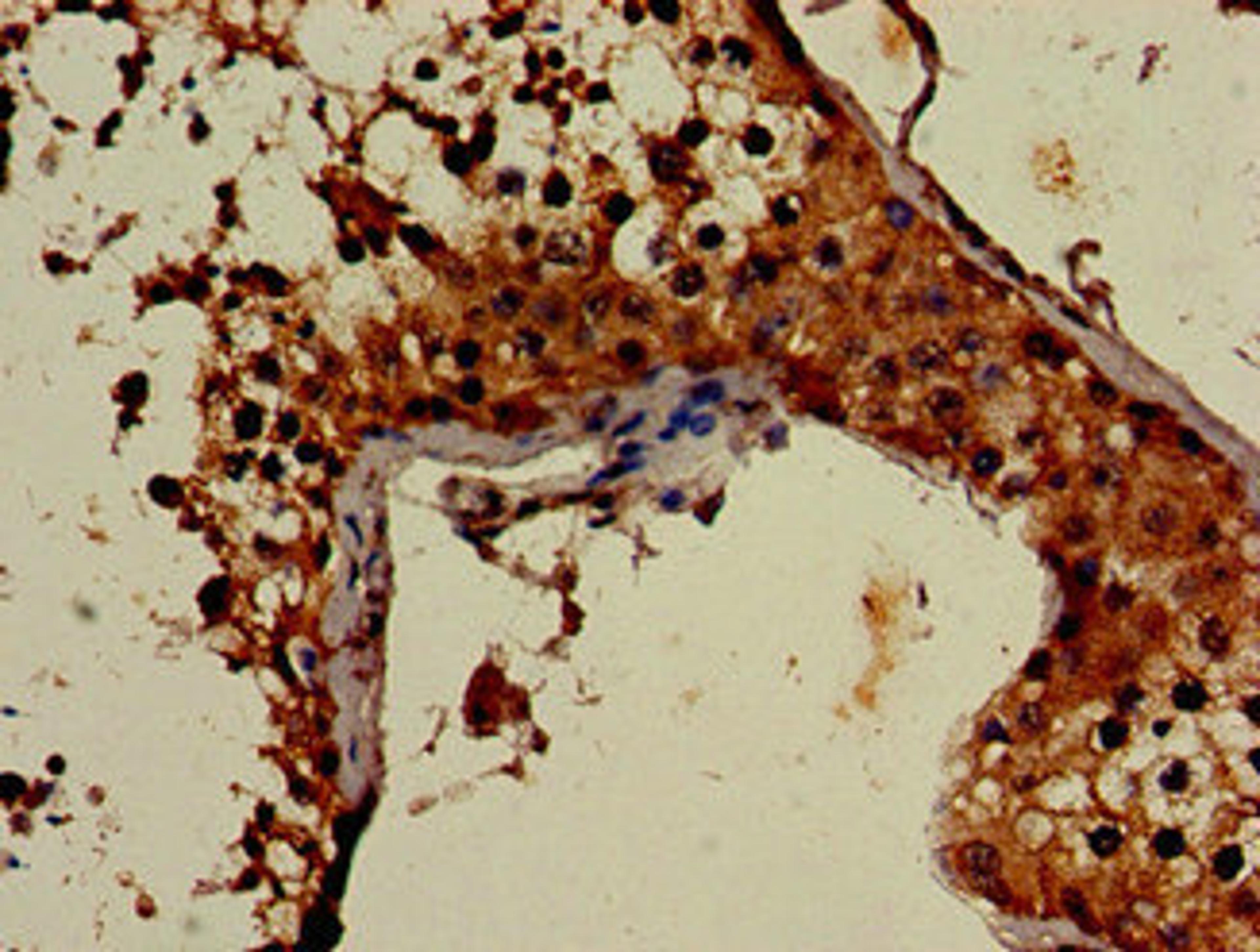 Immunohistochemistry of paraffin-embedded human testis tissue using CSB-PA836199LA01HU at dilution of 1:100