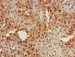 Immunohistochemistry of paraffin-embedded human adrenal gland tissue using CSB-PA883651LA01HU at dilution of 1:100