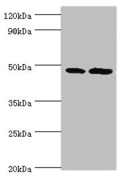 Western blot. All lanes: AP1M2 antibody at 2ug/ml. Lane 1: Mouse small intestine tissue. Lane 2: Mouse kidney tisueSecondary. Goat polyclonal to rabbit IgG at 1/10000 dilution. Predicted band size: 48 kDa. Observed band size: 48 kDa. 