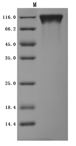 (Tris-Glycine gel) Discontinuous SDS-PAGE (reduced) with 5% enrichment gel and 15% separation gel.
