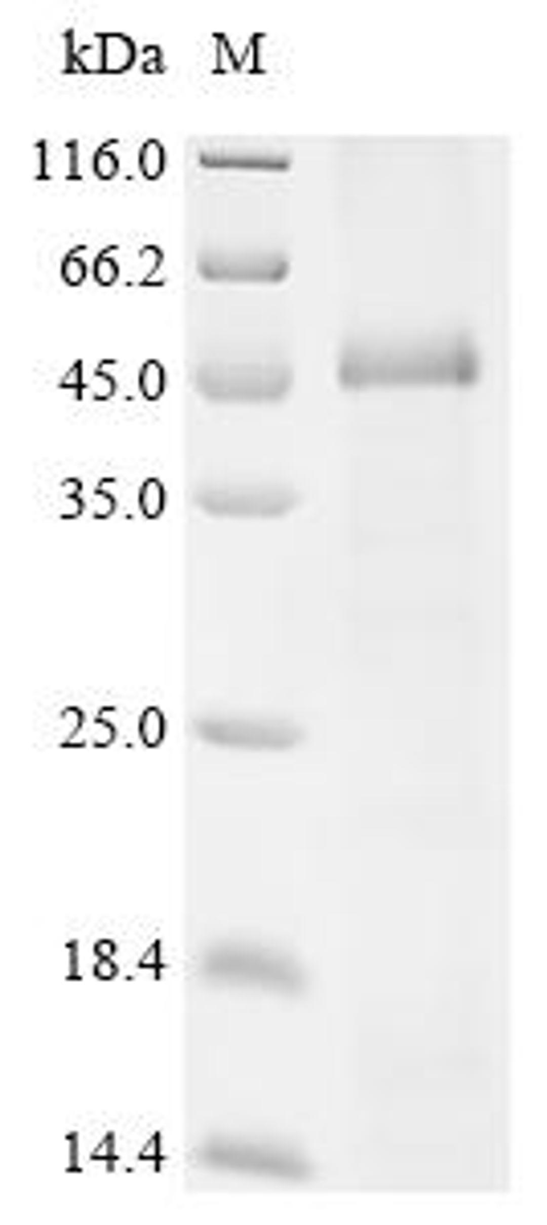 (Tris-Glycine gel) Discontinuous SDS-PAGE (reduced) with 5% enrichment gel and 15% separation gel.