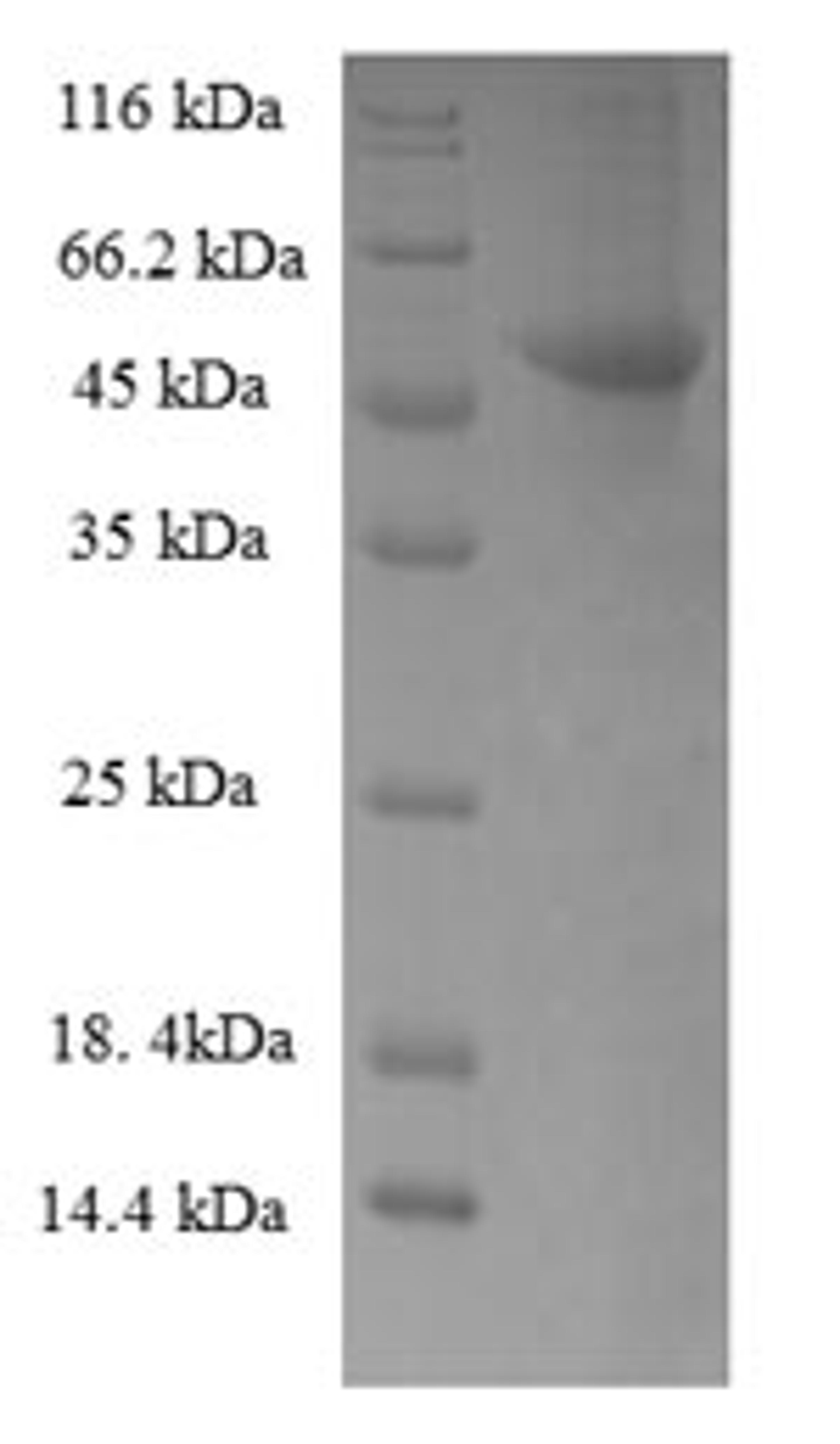 (Tris-Glycine gel) Discontinuous SDS-PAGE (reduced) with 5% enrichment gel and 15% separation gel.