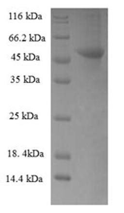 (Tris-Glycine gel) Discontinuous SDS-PAGE (reduced) with 5% enrichment gel and 15% separation gel.