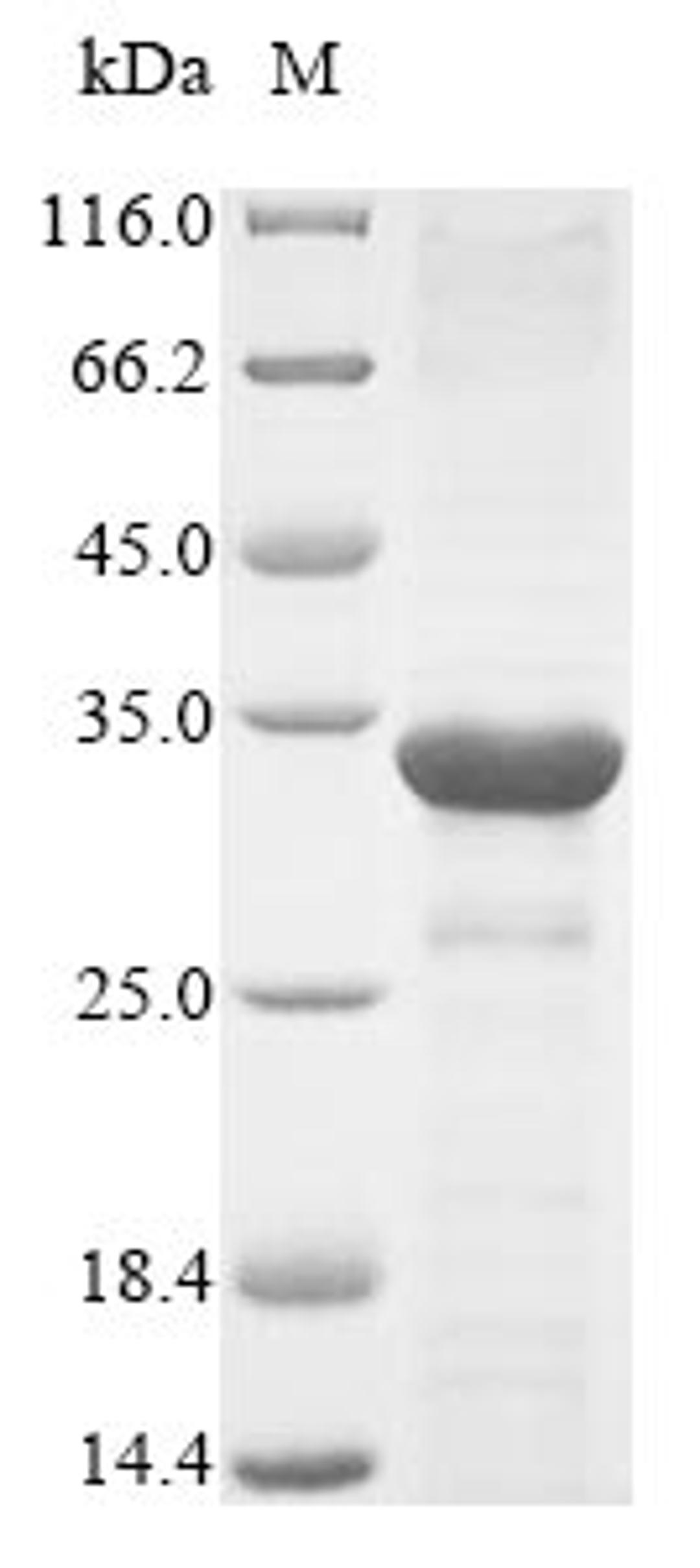 (Tris-Glycine gel) Discontinuous SDS-PAGE (reduced) with 5% enrichment gel and 15% separation gel.
