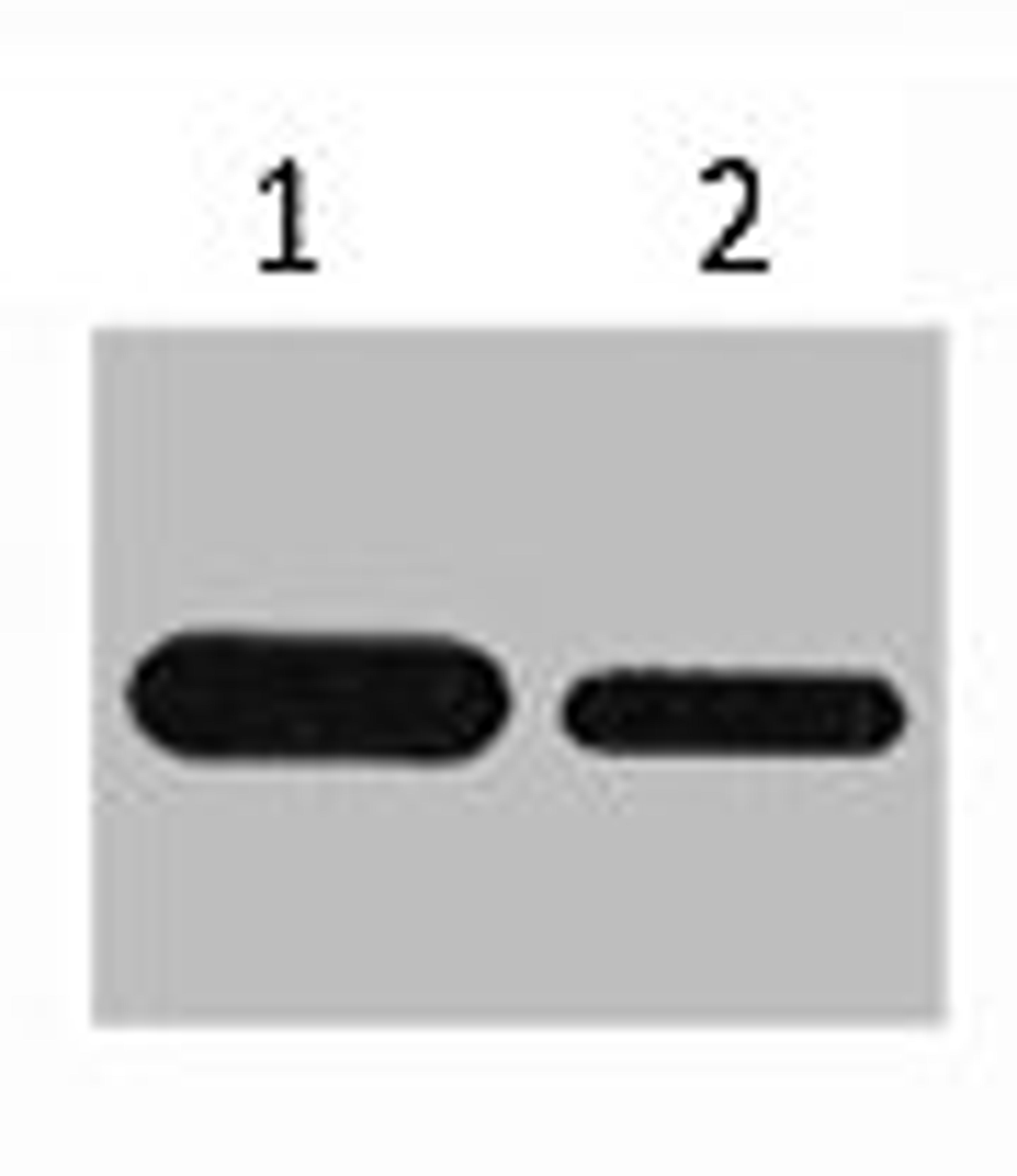 Western blot analysis of Recombinant protein, diluted at  1) 1:5000 2) 1:10000