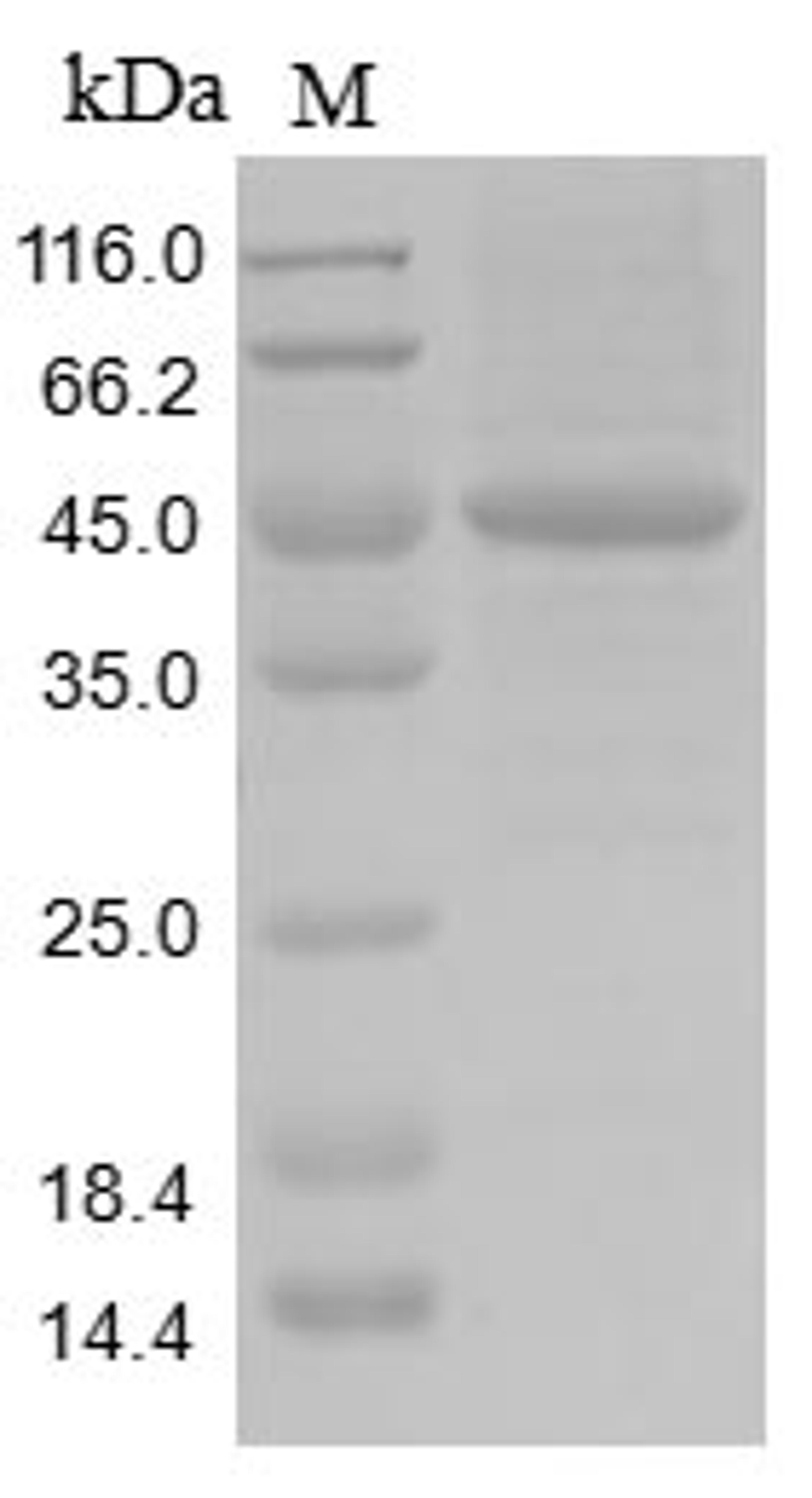 (Tris-Glycine gel) Discontinuous SDS-PAGE (reduced) with 5% enrichment gel and 15% separation gel.
