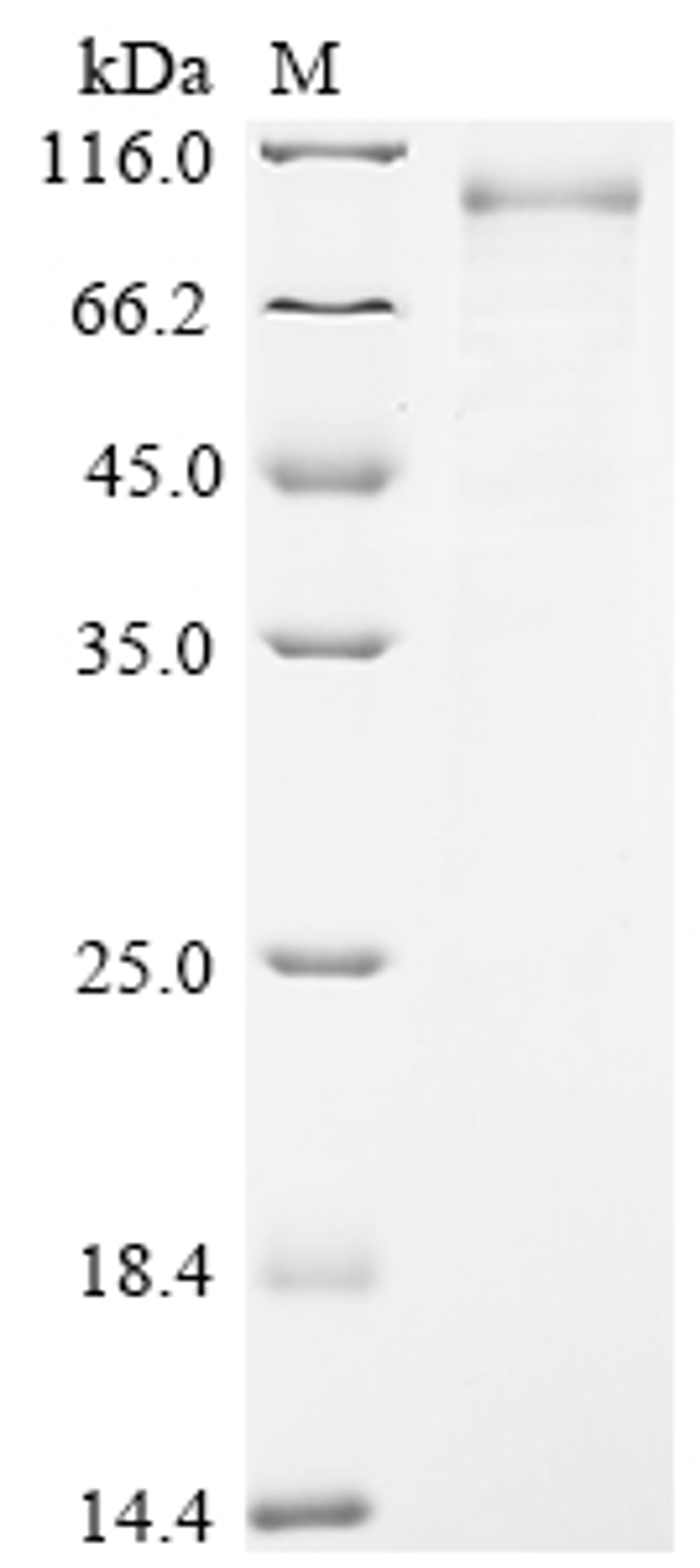 (Tris-Glycine gel) Discontinuous SDS-PAGE (reduced) with 5% enrichment gel and 15% separation gel.