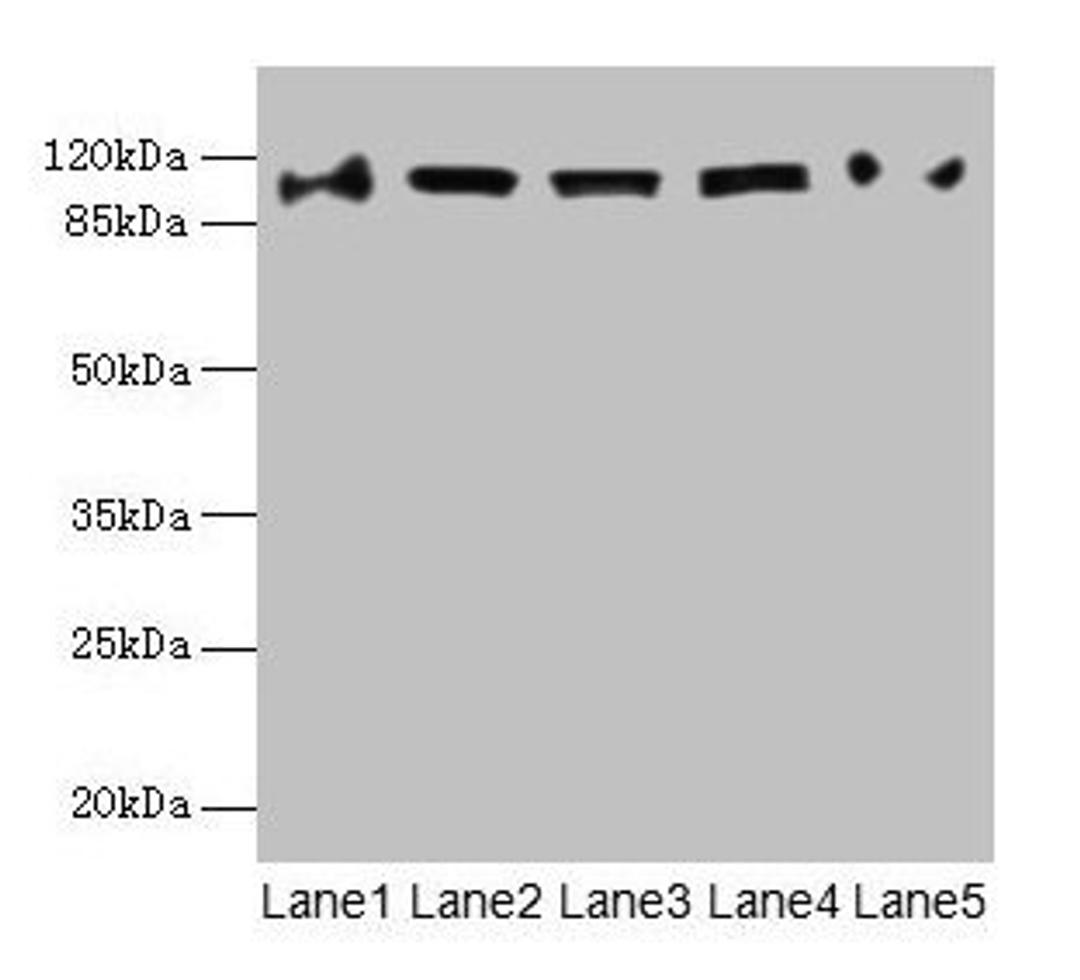Western blot. All lanes: COPB1 antibody at 1µg/ml. Lane 1: Hela whole cell lysate. Lane 2: Jurkat whole cell lysate. Lane 3: NIH/3T3 whole cell lysate. Lane 4: Mouse liver tissue. Lane 5: A549 whole cell lysate. Secondary. Goat polyclonal to rabbit IgG at 1/10000 dilution. Predicted band size: 108 kDa. Observed band size: 108 kDa