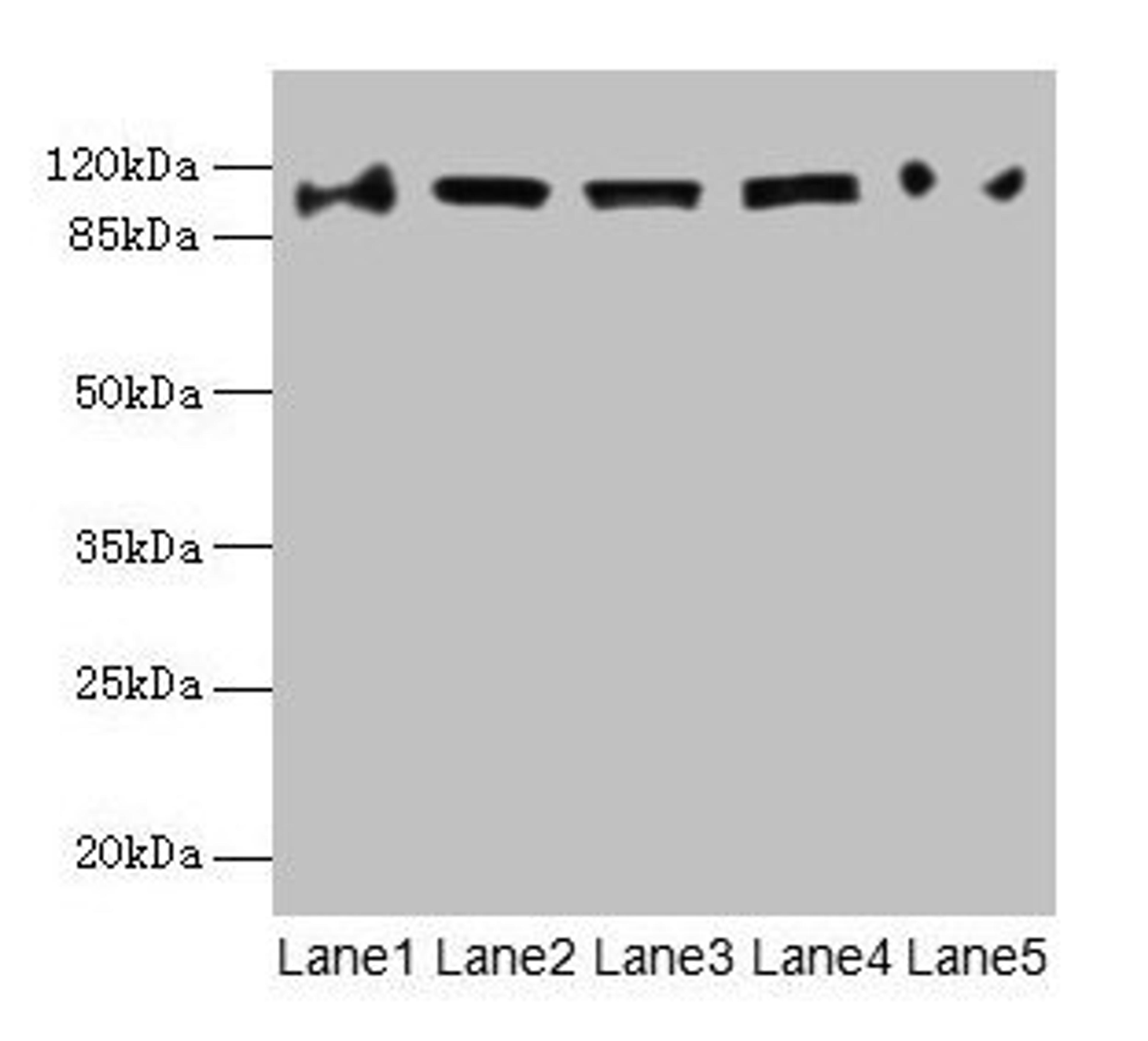 Western blot. All lanes: COPB1 antibody at 1µg/ml. Lane 1: Hela whole cell lysate. Lane 2: Jurkat whole cell lysate. Lane 3: NIH/3T3 whole cell lysate. Lane 4: Mouse liver tissue. Lane 5: A549 whole cell lysate. Secondary. Goat polyclonal to rabbit IgG at 1/10000 dilution. Predicted band size: 108 kDa. Observed band size: 108 kDa