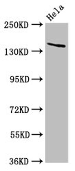 Western Blot. Positive WB detected in: Hela whole cell lysate. All lanes: LAMC2 antibody at 5ug/ml. Secondary. Goat polyclonal to rabbit IgG at 1/50000 dilution. Predicted band size: 131, 122 kDa. Observed band size: 140 kDa. 