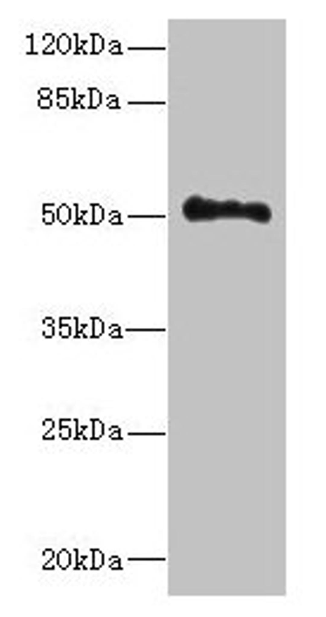 Western blot. All lanes: UNC93A antibody at 14µg/ml + Hela whole cell lysate. Secondary. Goat polyclonal to rabbit IgG at 1/10000 dilution. Predicted band size: 51, 46 kDa. Observed band size: 51 kDa