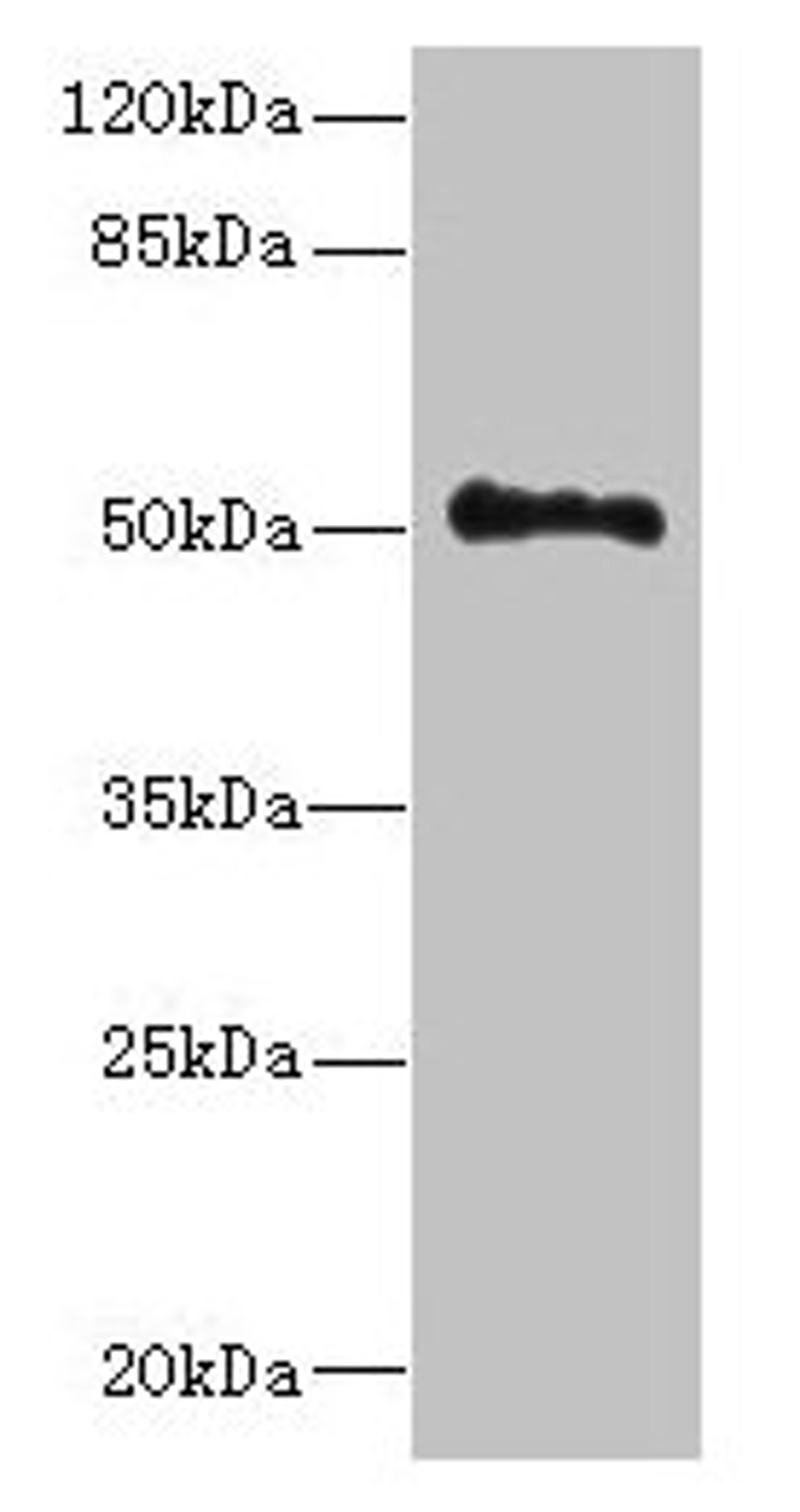 Western blot. All lanes: UNC93A antibody at 14µg/ml + Hela whole cell lysate. Secondary. Goat polyclonal to rabbit IgG at 1/10000 dilution. Predicted band size: 51, 46 kDa. Observed band size: 51 kDa