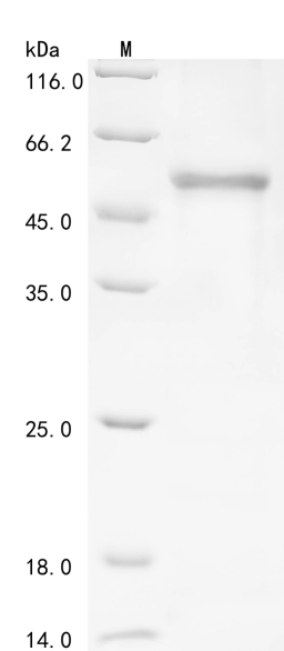 (Tris-Glycine gel) Discontinuous SDS-PAGE (reduced) with 5% enrichment gel and 15% separation gel.