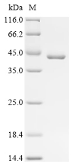 (Tris-Glycine gel) Discontinuous SDS-PAGE (reduced) with 5% enrichment gel and 15% separation gel.