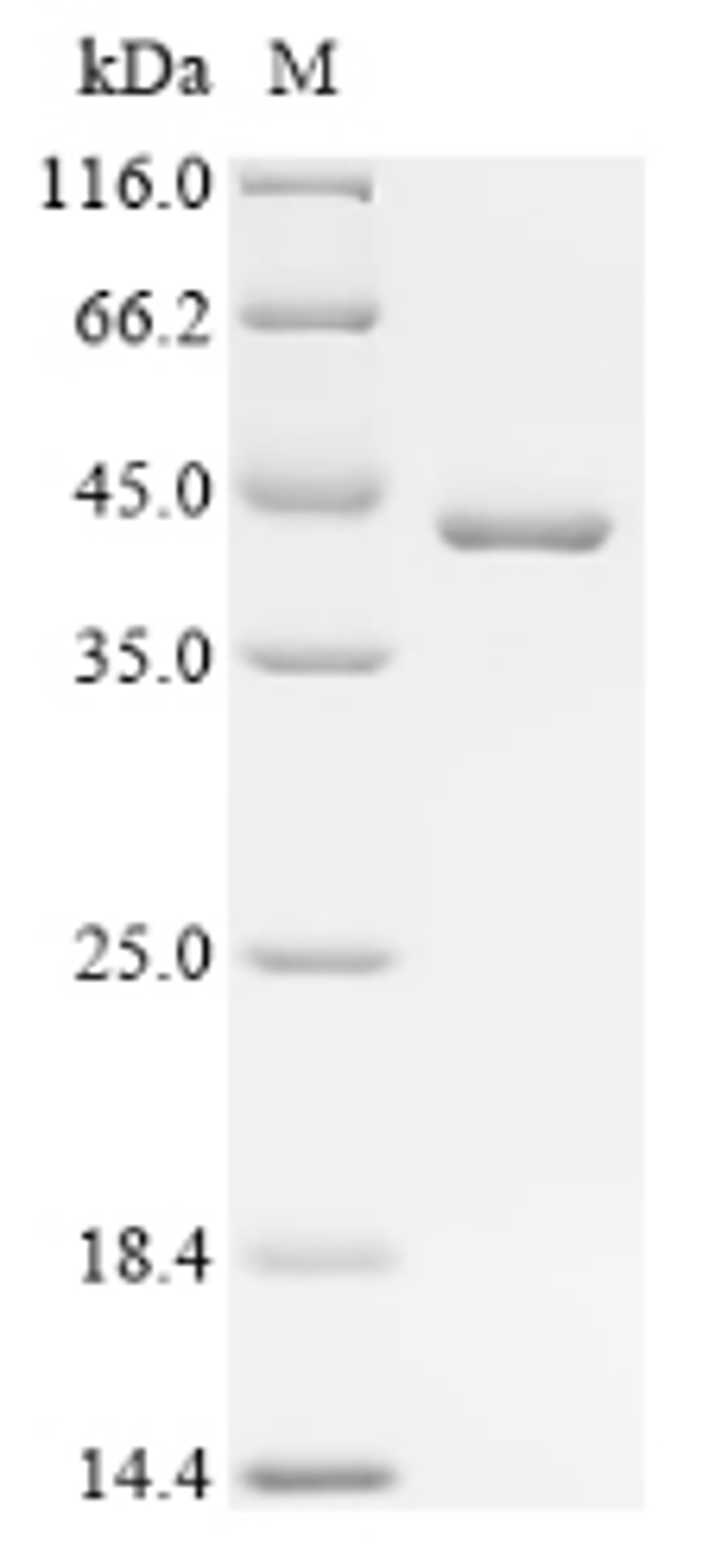 (Tris-Glycine gel) Discontinuous SDS-PAGE (reduced) with 5% enrichment gel and 15% separation gel.