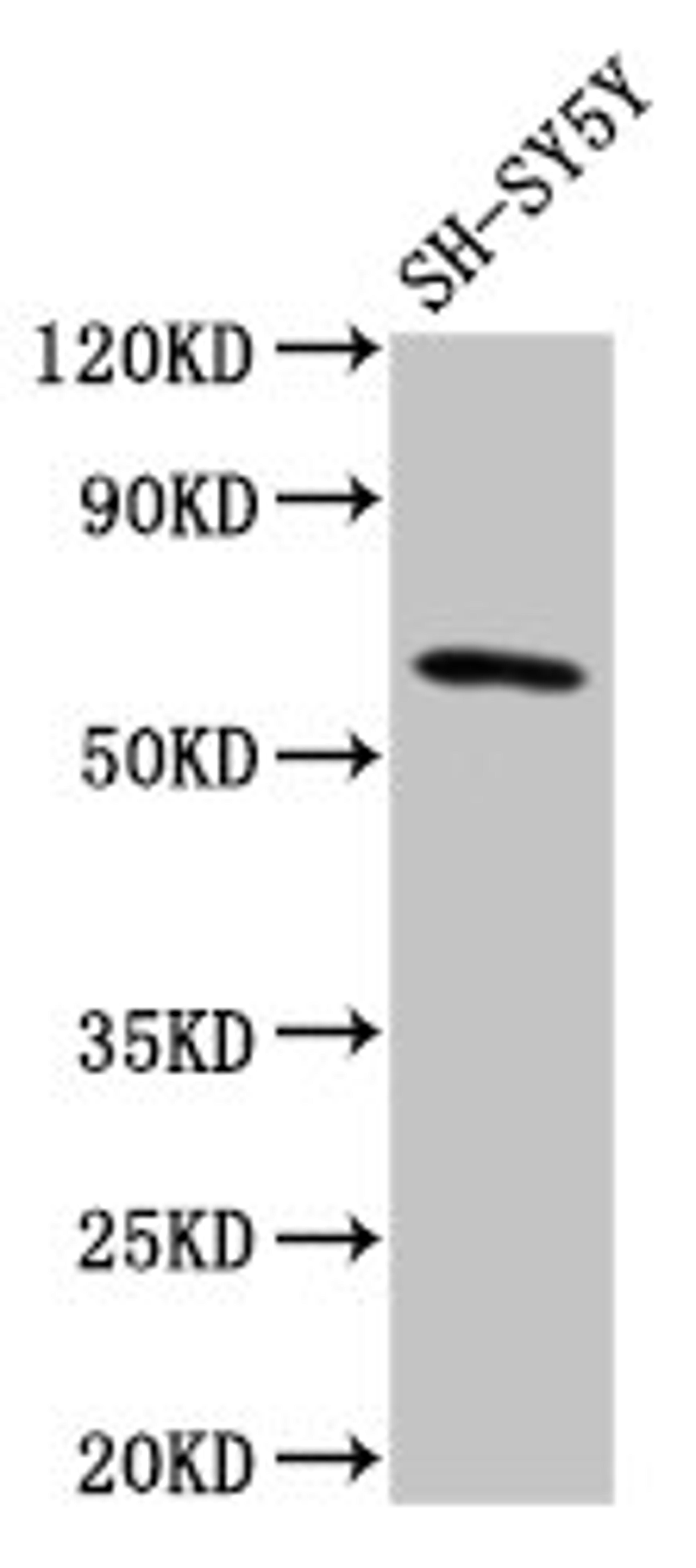 Western Blot. Positive WB detected in: SH-SY5Y whole cell lysate. All lanes: DEAF1 antibody at 3.2ug/ml. Secondary. Goat polyclonal to rabbit IgG at 1/50000 dilution. Predicted band size: 60, 59, 53, 52 kDa. Observed band size: 60 kDa. 