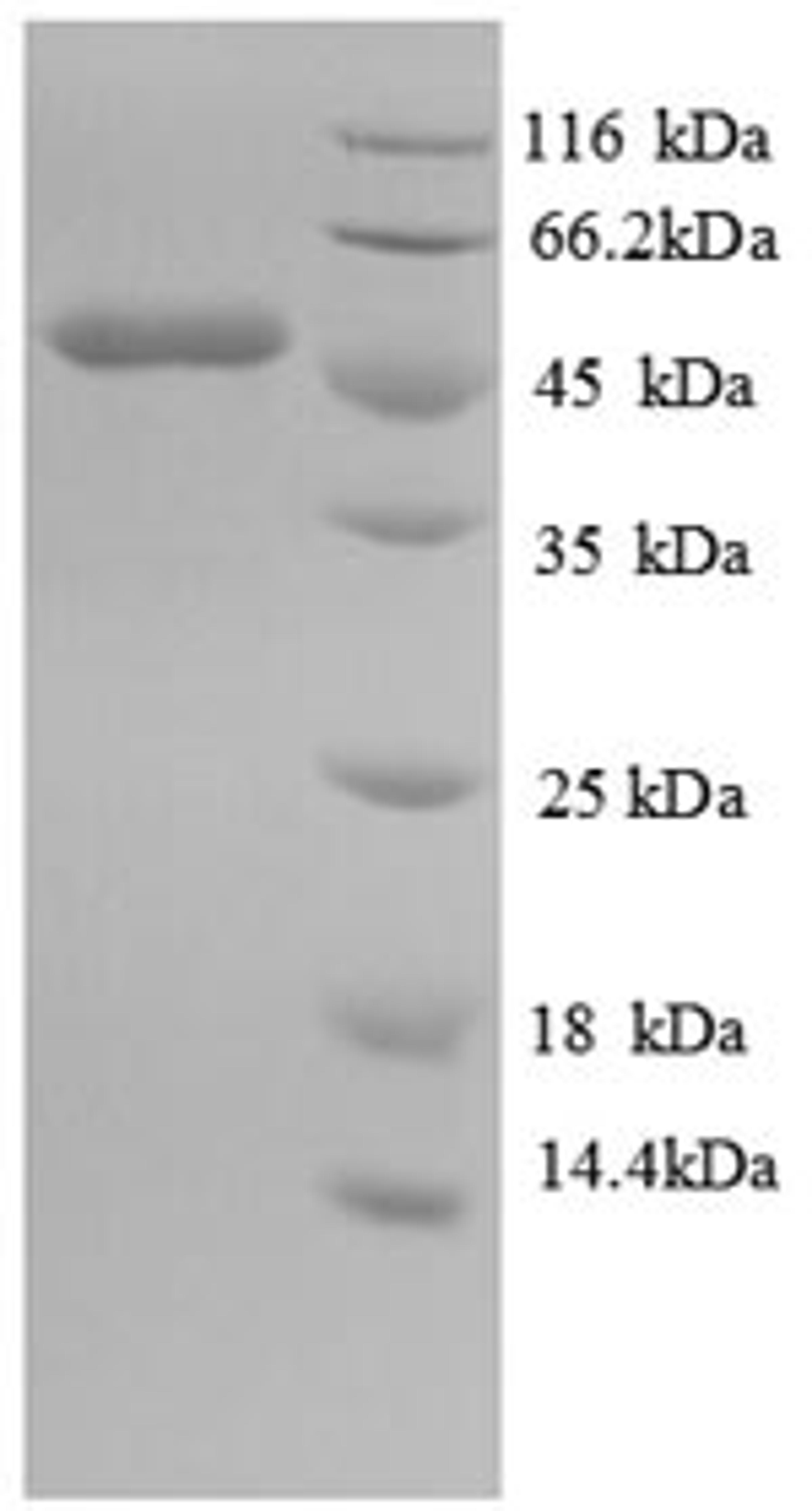 (Tris-Glycine gel) Discontinuous SDS-PAGE (reduced) with 5% enrichment gel and 15% separation gel.