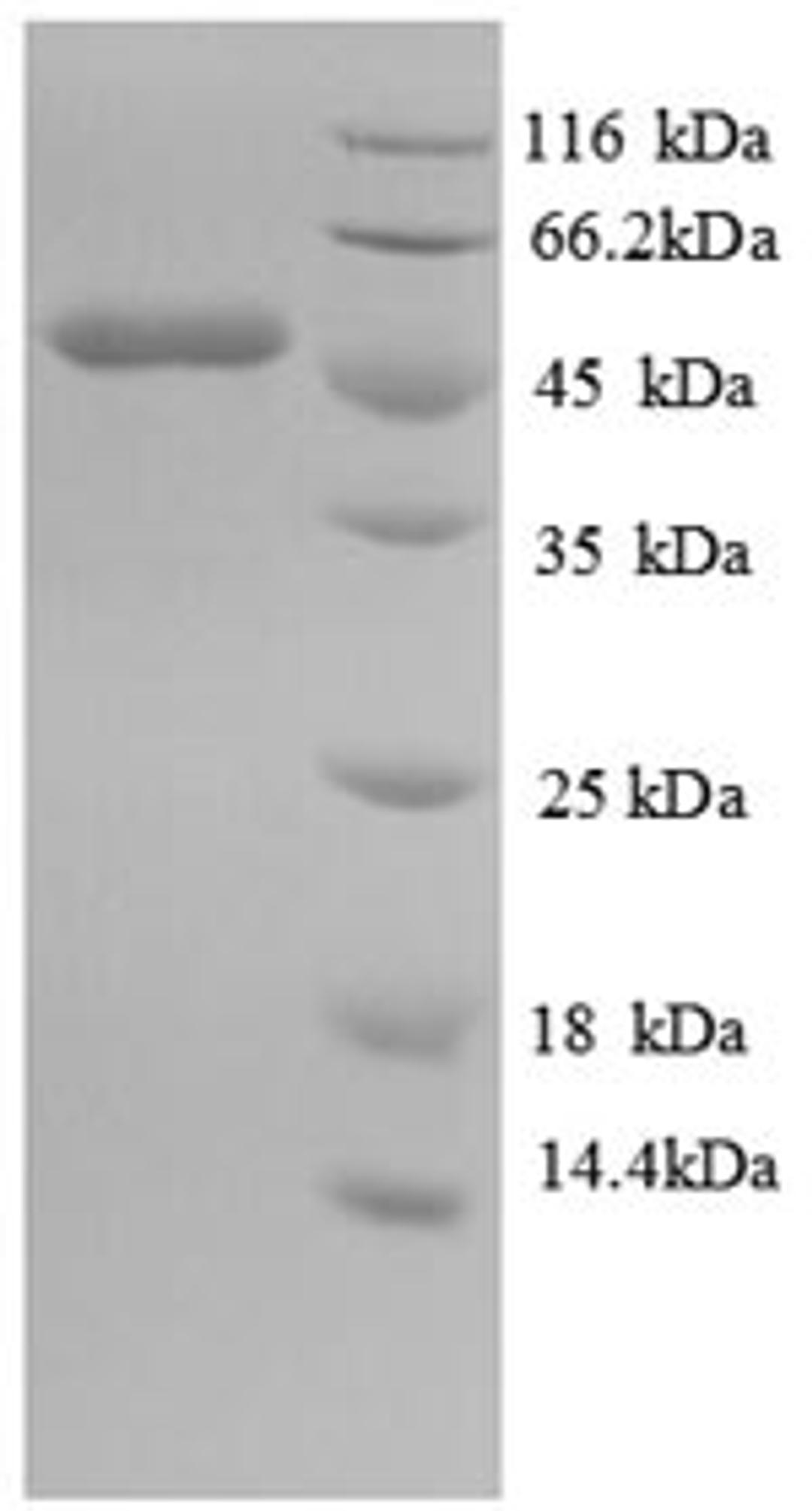 (Tris-Glycine gel) Discontinuous SDS-PAGE (reduced) with 5% enrichment gel and 15% separation gel.