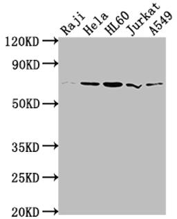 Western Blot. Positive WB detected in: Raji whole cell lysate, Hela whole cell lysate, HL60 whole cell lysate, Jurkat whole cell lysate, A549 whole cell lysate. All lanes: PRMT5 antibody at 1:2000. Secondary. Goat polyclonal to rabbit IgG at 1/50000 dilution. Predicted band size: 73, 72, 54, 68, 67 kDa. Observed band size: 73 kDa. 