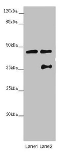 Western blot. All lanes: CEP44 antibody at 3.09 ug/ml. Lane 1: Jurkat whole cell lysate. Lane 2: MCF-7 whole cell lysate. Secondary. Goat polyclonal to rabbit IgG at 1/10000 dilution. Predicted band size: 44 kDa. Observed band size: 44, 36 kDa. 