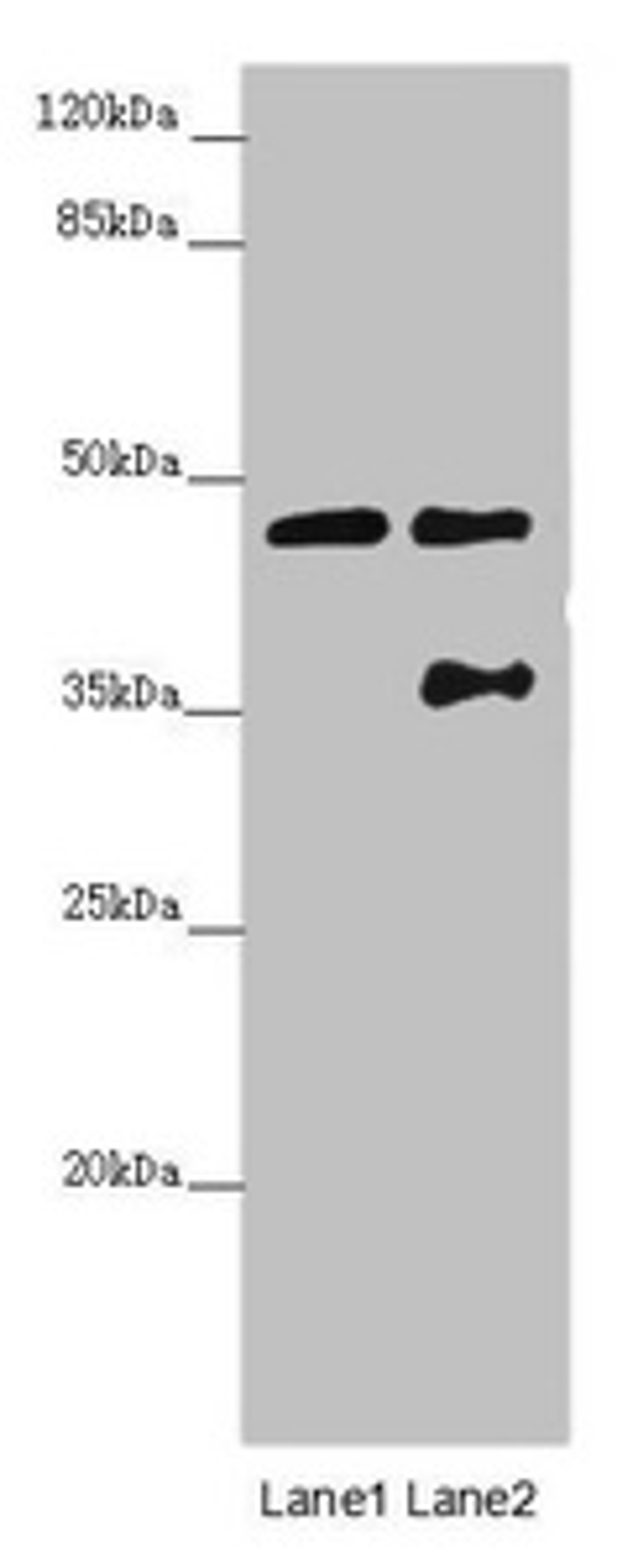 Western blot. All lanes: CEP44 antibody at 3.09 ug/ml. Lane 1: Jurkat whole cell lysate. Lane 2: MCF-7 whole cell lysate. Secondary. Goat polyclonal to rabbit IgG at 1/10000 dilution. Predicted band size: 44 kDa. Observed band size: 44, 36 kDa. 