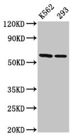 Western Blot. Positive WB detected in: K562 whole cell lysate, 293 whole cell lysate. All lanes: CCT7 antibody at 3µg/ml. Secondary. Goat polyclonal to rabbit IgG at 1/50000 dilution. Predicted band size: 60, 38, 55, 51 kDa. Observed band size: 60 kDa