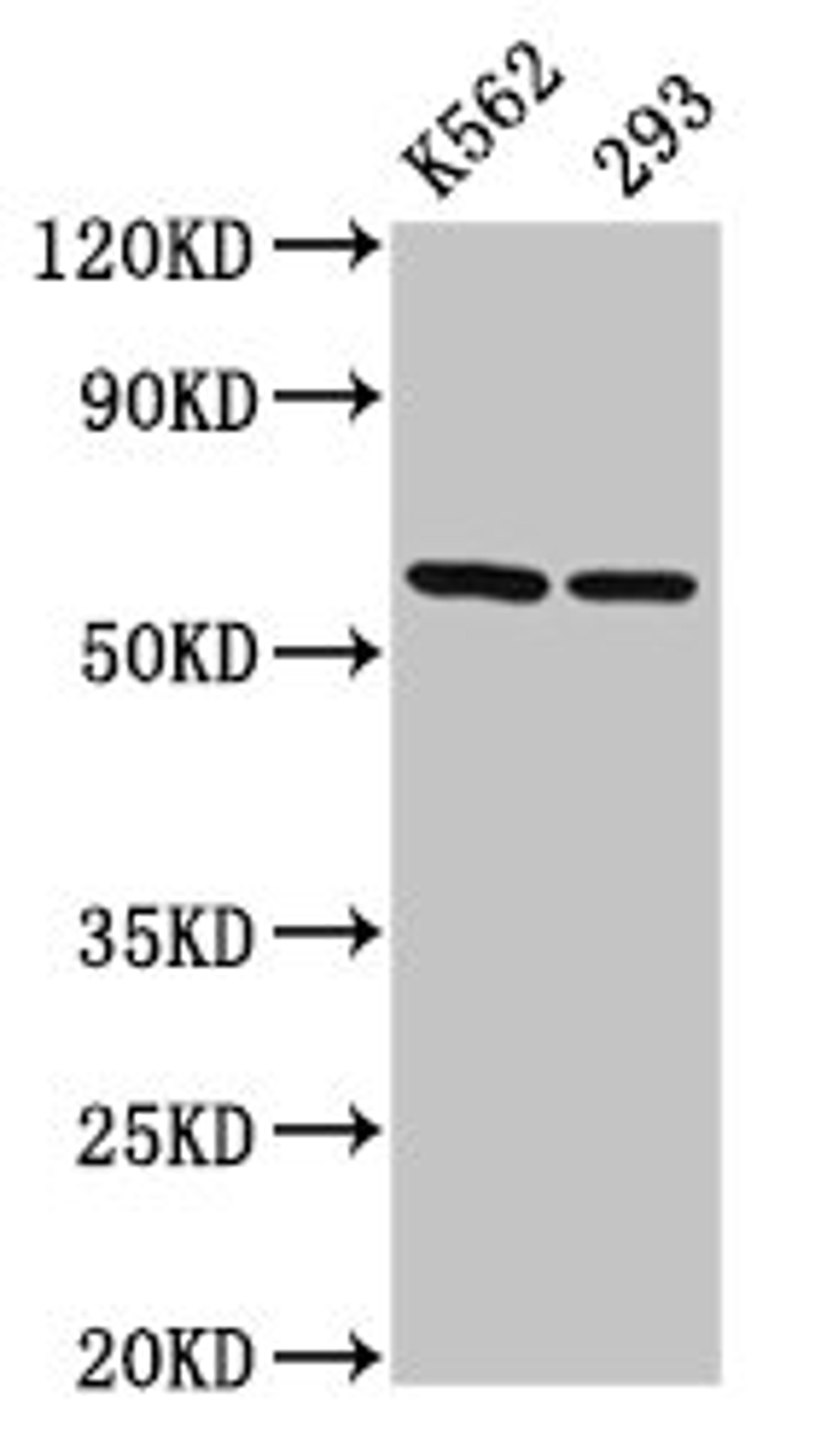 Western Blot. Positive WB detected in: K562 whole cell lysate, 293 whole cell lysate. All lanes: CCT7 antibody at 3µg/ml. Secondary. Goat polyclonal to rabbit IgG at 1/50000 dilution. Predicted band size: 60, 38, 55, 51 kDa. Observed band size: 60 kDa