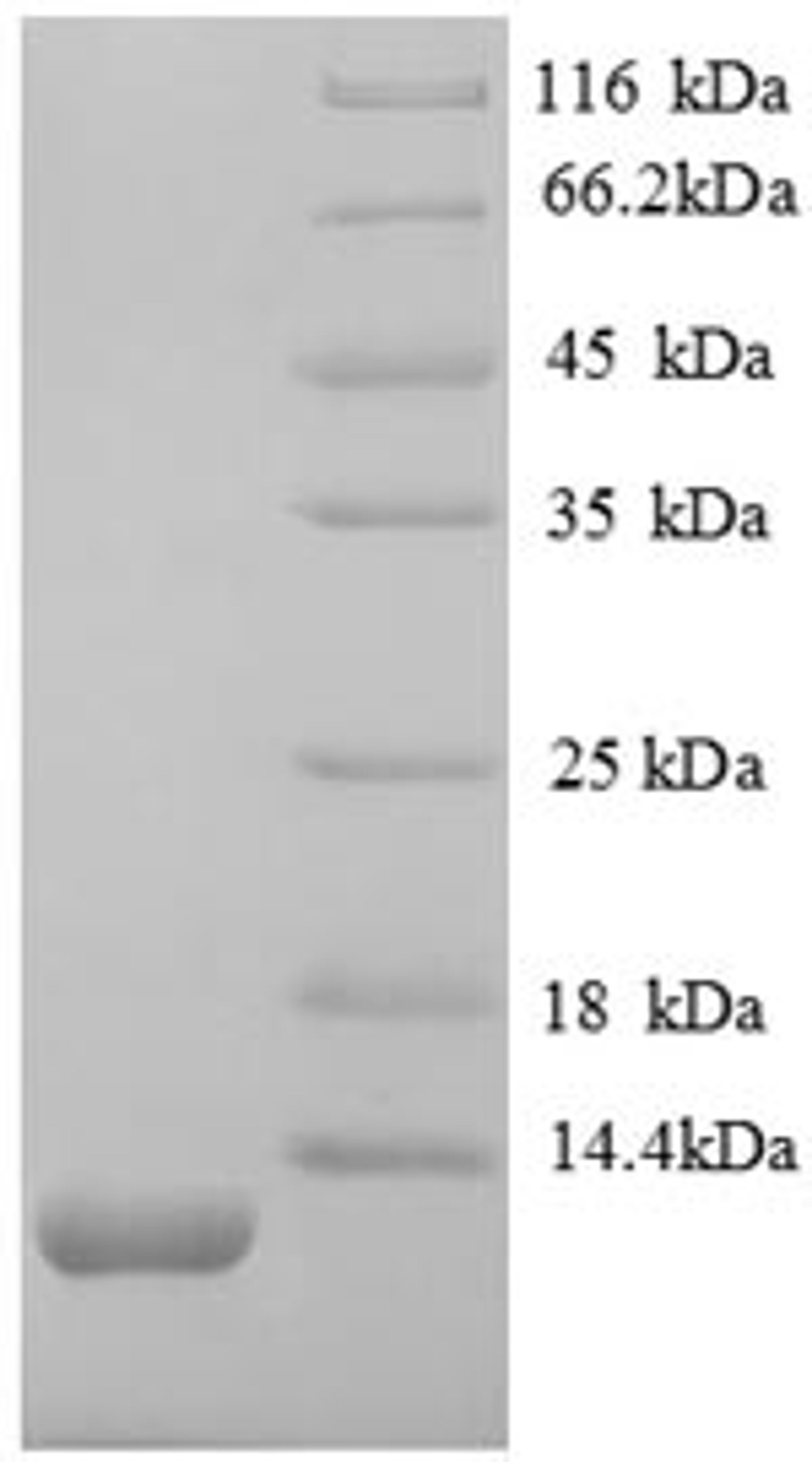 (Tris-Glycine gel) Discontinuous SDS-PAGE (reduced) with 5% enrichment gel and 15% separation gel.