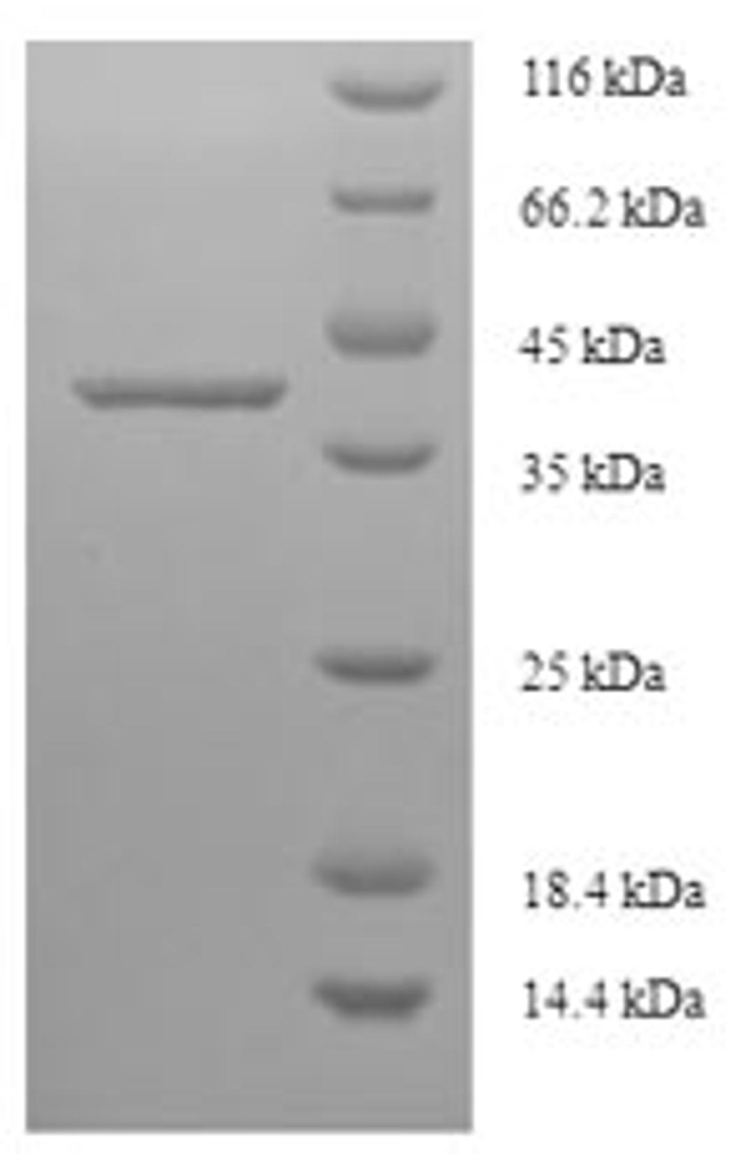 (Tris-Glycine gel) Discontinuous SDS-PAGE (reduced) with 5% enrichment gel and 15% separation gel.
