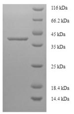 (Tris-Glycine gel) Discontinuous SDS-PAGE (reduced) with 5% enrichment gel and 15% separation gel.