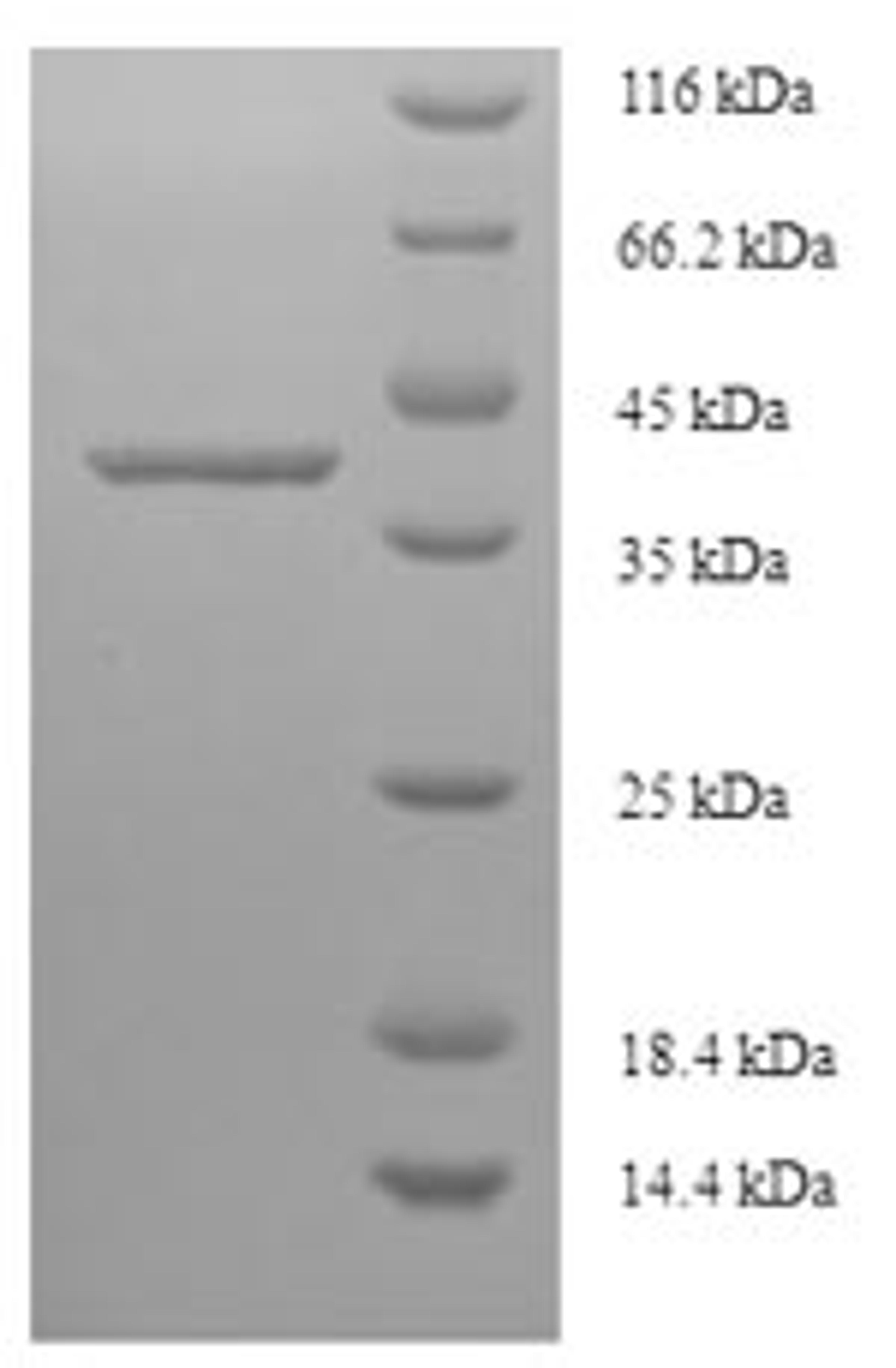 (Tris-Glycine gel) Discontinuous SDS-PAGE (reduced) with 5% enrichment gel and 15% separation gel.