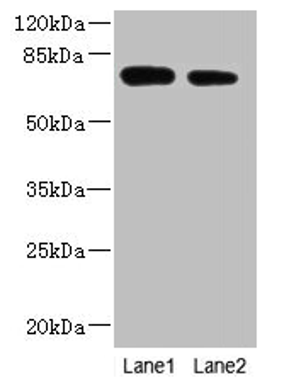 Western blot. All lanes: NBPF3 antibody at 1.2µg/ml. Lane 1: PC-3 whole cell lysate. Lane 2: HT29 whole cell lysate. Secondary. Goat polyclonal to rabbit IgG at 1/10000 dilution. Predicted band size: 73, 68, 72, 33, 66 kDa. Observed band size: 73 kDa