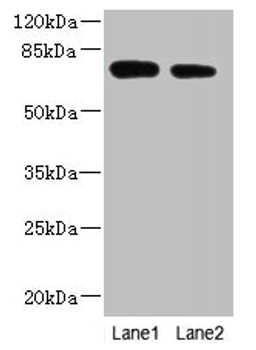 Western blot. All lanes: NBPF3 antibody at 1.2µg/ml. Lane 1: PC-3 whole cell lysate. Lane 2: HT29 whole cell lysate. Secondary. Goat polyclonal to rabbit IgG at 1/10000 dilution. Predicted band size: 73, 68, 72, 33, 66 kDa. Observed band size: 73 kDa