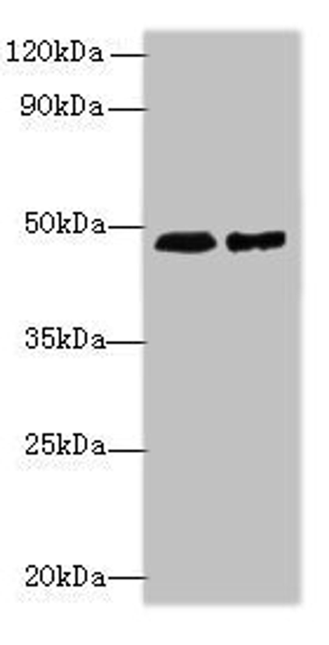 Western blot. All lanes: AARSD1 antibody at 0.8µg/ml. Lane 1: Hela whole cell lysate. Lane 2: U251 whole cell lysate. Secondary. Goat polyclonal to rabbit IgG at 1/10000 dilution. Predicted band size: 46, 59, 66 kDa. Observed band size: 46 kDa