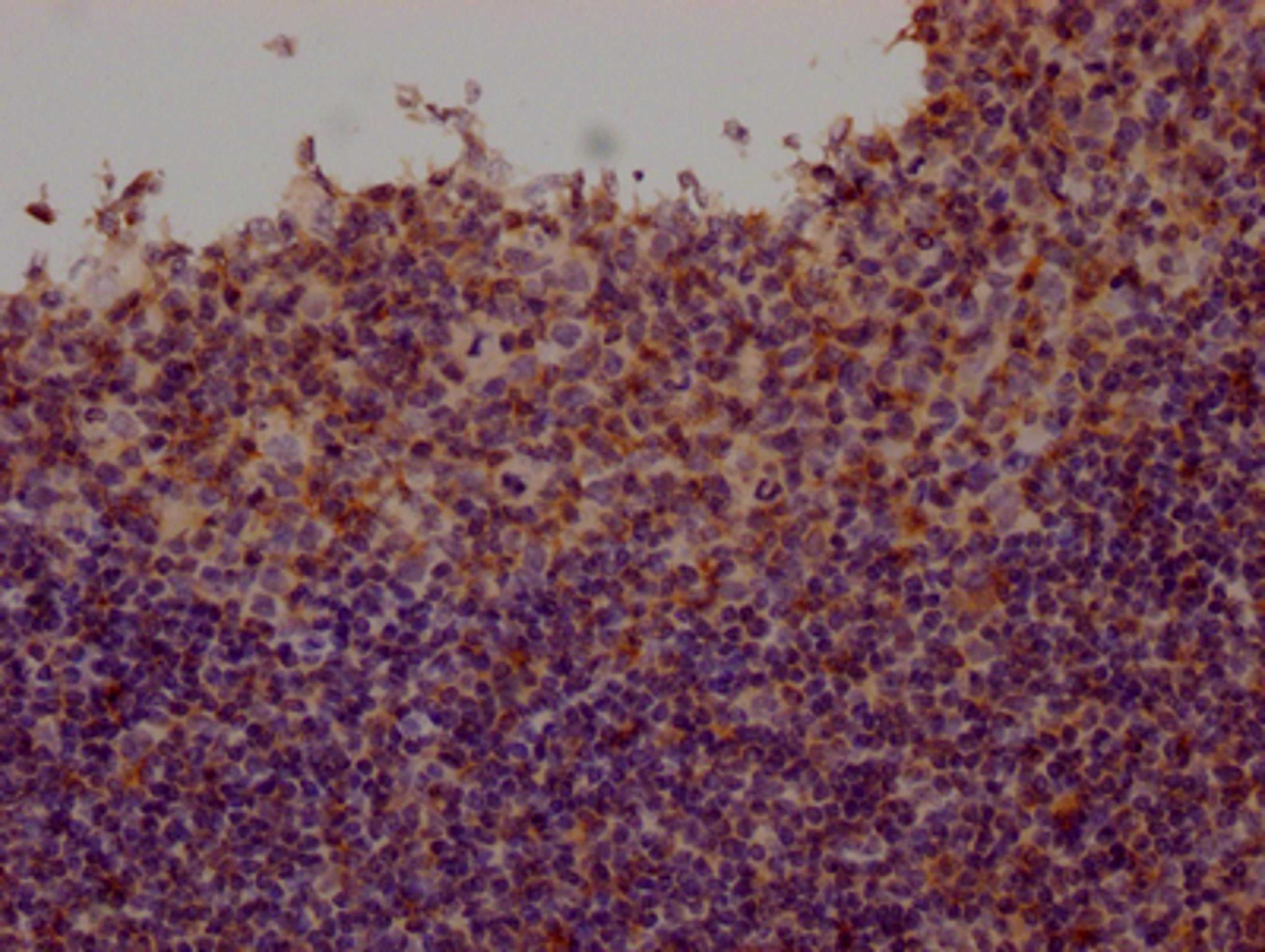 IHC image of CSB-RA699767A0HU diluted at 1:100 and staining in paraffin-embedded human tonsil tissue performed on a Leica BondTM system. After dewaxing and hydration, antigen retrieval was mediated by high pressure in a citrate buffer (pH 6.0). Section was blocked with 10% normal goat serum 30min at RT. Then primary antibody (1% BSA) was incubated at 4℃ overnight. The primary is detected by a Goat anti-rabbit IgG polymer labeled by HRP and visualized using 0.05% DAB.