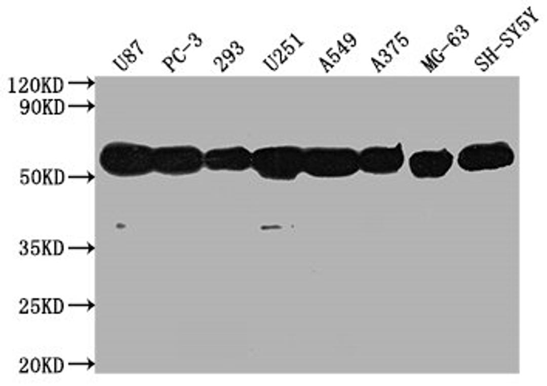 Western Blot. Positive WB detected in:  U87 whole cell lysate, PC-3 whole cell lysate, 293 whole cell lysate, U251 whole cell lysate, A549 whole cell lysate, A375 whole cell lysate, MG-63 whole cell lysate, SH-SY5Y whole cell lysate, . All lanes: TUBA1A antibody at 1:5000. Secondary. Goat polyclonal to Mouse IgG at 1/10000 dilution. Predicted band size: 52 kDa. Observed band size: 52 kDa. 