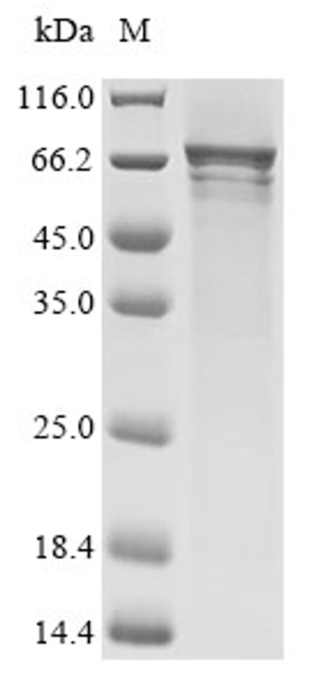 (Tris-Glycine gel) Discontinuous SDS-PAGE (reduced) with 5% enrichment gel and 15% separation gel.