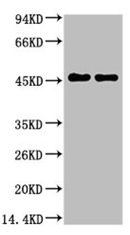 Western blot analysis of Rat Brain Tissue, diluted at 1:5000.