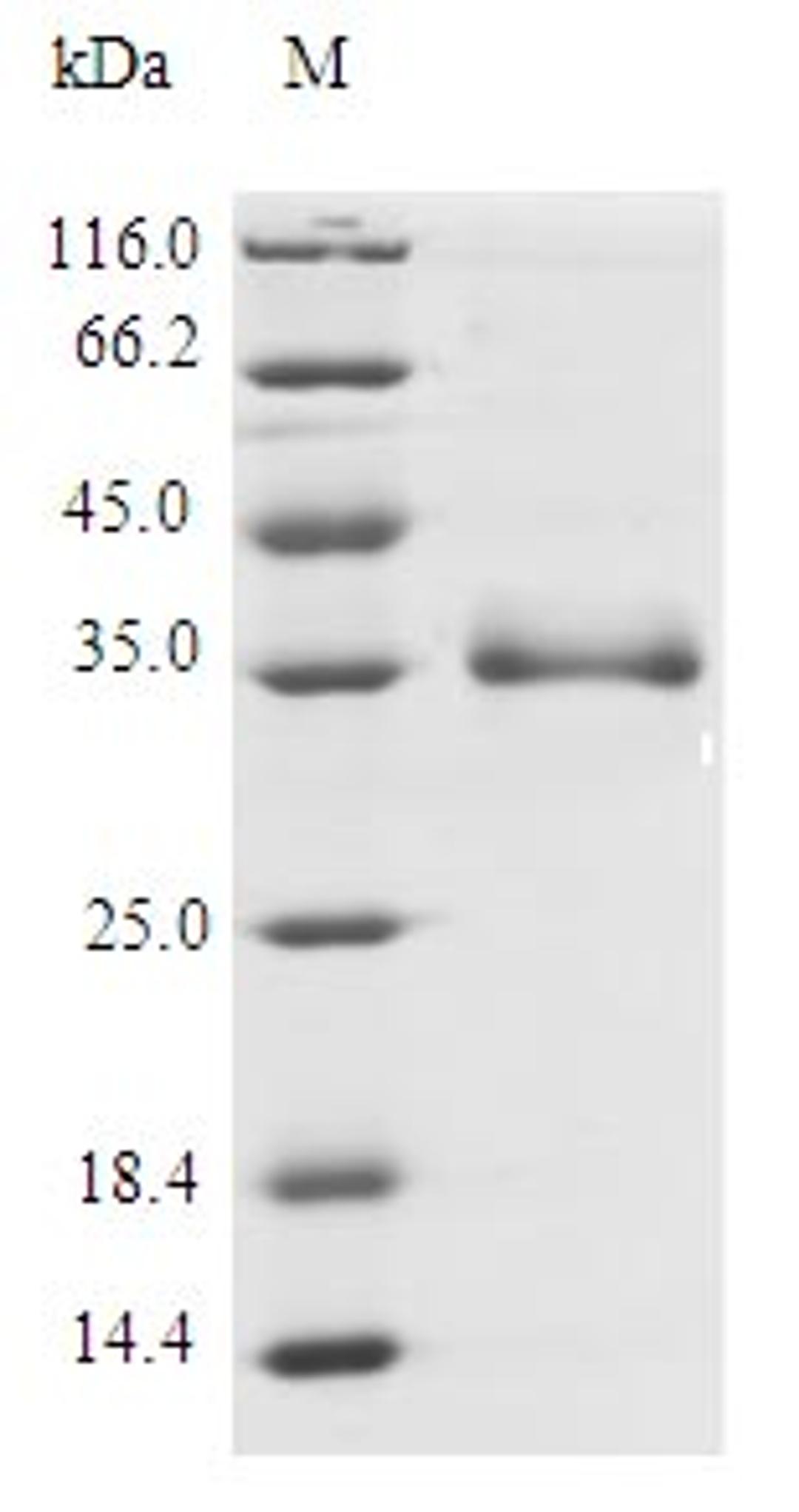 (Tris-Glycine gel) Discontinuous SDS-PAGE (reduced) with 5% enrichment gel and 15% separation gel.
