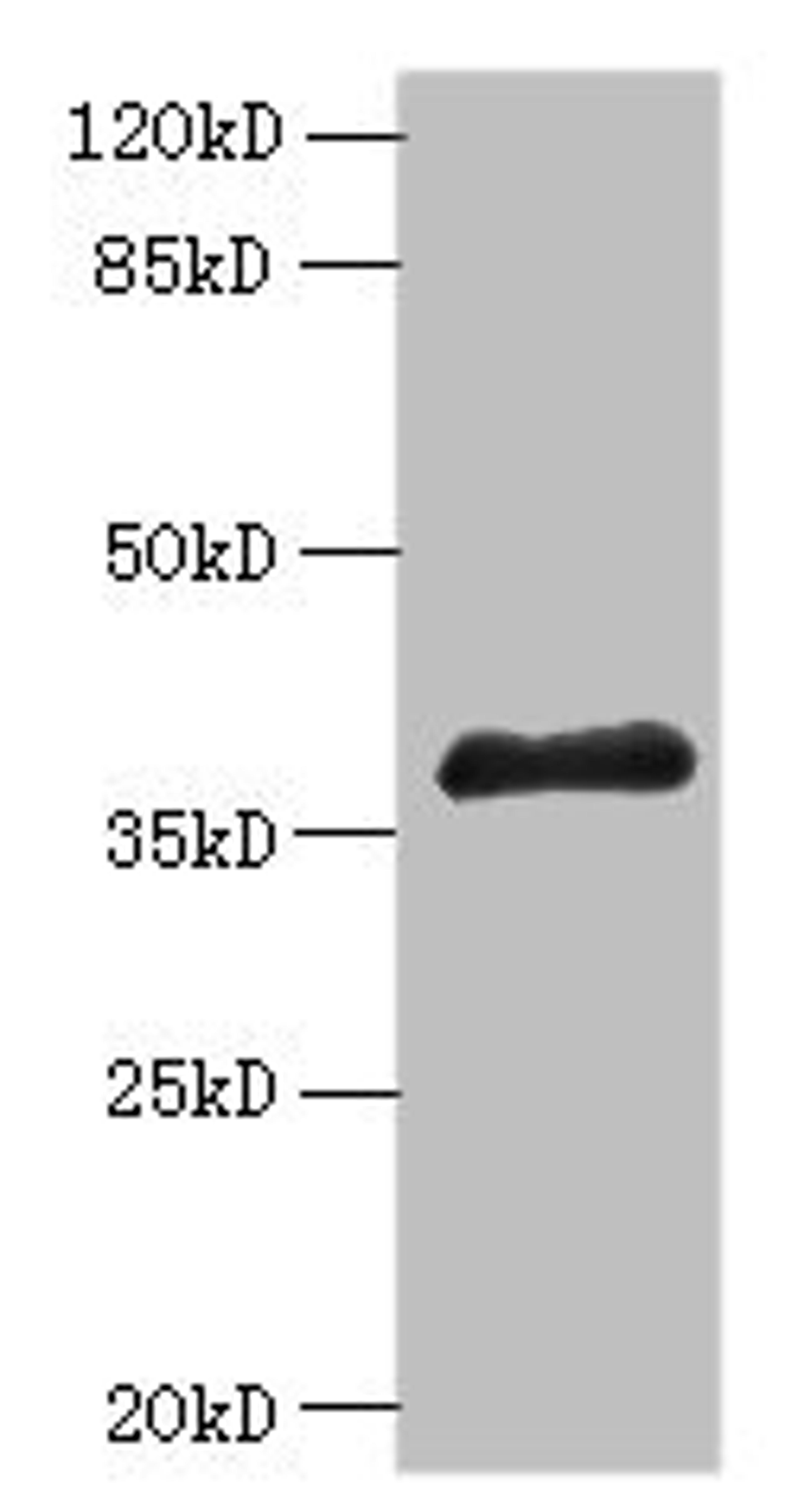 Western blot. All lanes: ELAVL1 antibody at 6µg/ml + A431 whole cell lysate. Secondary. Goat polyclonal to rabbit IgG at 1/10000 dilution. Predicted band size: 37, 39 kDa. Observed band size: 37 kDa