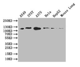 Western Blot. Positive WB detected in: A549 whole cell lysate, SY5Y whole cell lysate, A375 whole cell lysate, HEPG2 whole cell lysate, Mouse Lung tissue lysate. All lanes: DDR2 antibody at 1:1000. Secondary. Goat polyclonal to rabbit IgG at 1/50000 dilution. Predicted band size: 96 kDa. Observed band size: 110 kDa. 