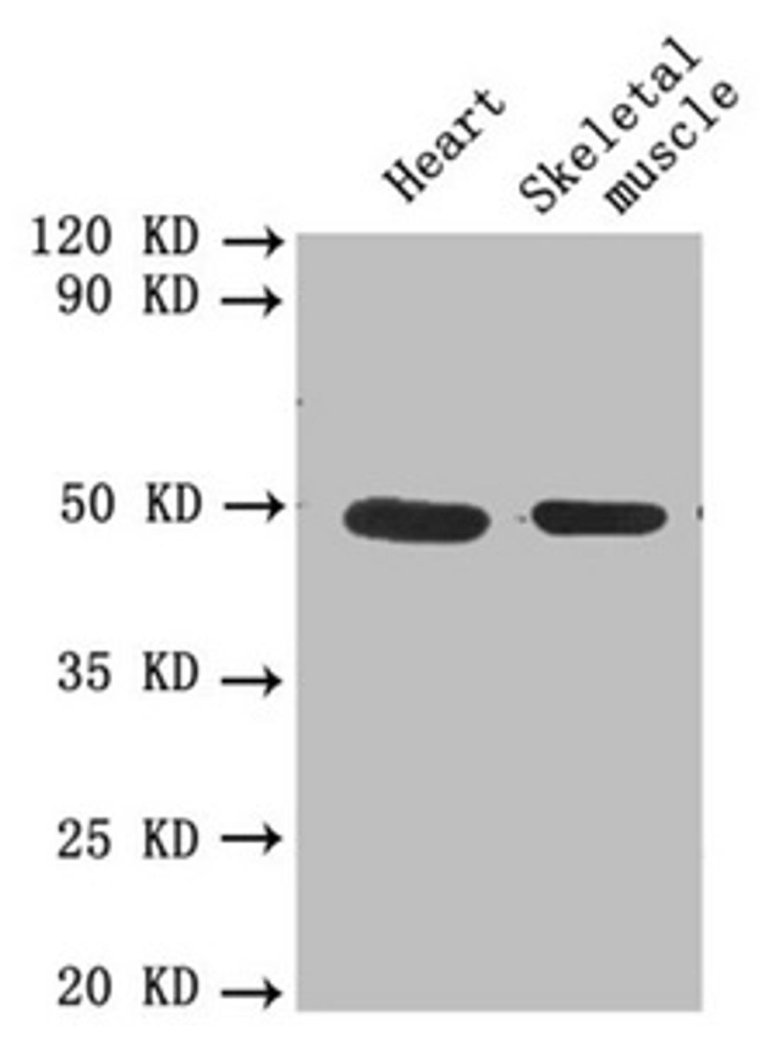 Western blot. All lanes: PLAU antibody at 1.8µg/ml. Lane 1: Mouse heart tissue. Lane 2: Mouse skeletal muscle tissue. Secondary. Goat polyclonal to rabbit IgG at 1/10000 dilution. Predicted band size: 49, 47 kDa. Observed band size: 49 kDa