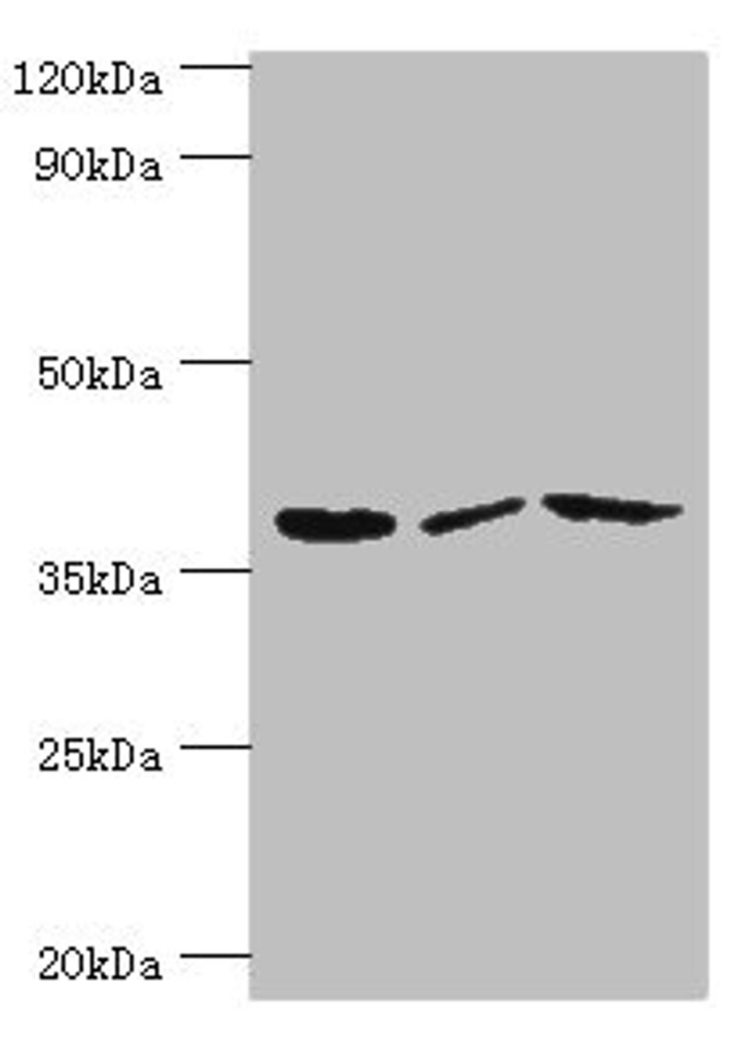 Western blot. All lanes: P2RY14 antibody at 12ug/ml. Lane 1: Mouse heart tissue. Lane 2: Mouse stomach tissue. Lane 3: Mouse small intestine tissue. Secondary. Goat polyclonal to rabbit IgG at 1/10000 dilution. Predicted band size: 39 kDa. Observed band size: 39 kDa. 