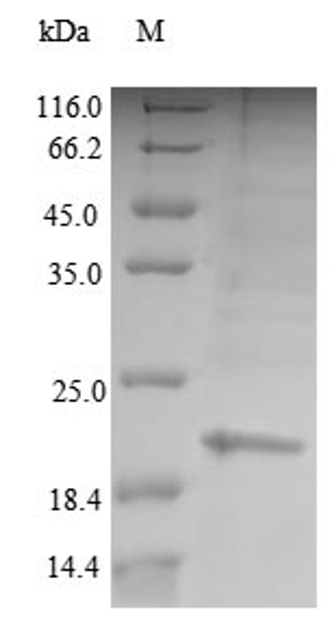 (Tris-Glycine gel) Discontinuous SDS-PAGE (reduced) with 5% enrichment gel and 15% separation gel.