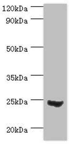 Western blot. All lanes: Mitotic spindle assembly checkpoint protein MAD2A antibody at 3ug/ml + 293T whole cell lysate. Secondary. Goat polyclonal to rabbit IgG at 1/10000 dilution. Predicted band size: 24, 11 kDa. Observed band size: 24 kDa. 
