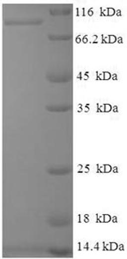 (Tris-Glycine gel) Discontinuous SDS-PAGE (reduced) with 5% enrichment gel and 15% separation gel.