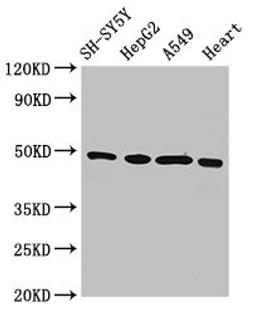 Western Blot. Positive WB detected in: SH-SY5Y whole cell lysate, HepG2 whole cell lysate, A549 whole cell lysate, Rat heart tissue. All lanes: HOXA5 antibody at 3ug/ml. Secondary. Goat polyclonal to rabbit IgG at 1/50000 dilution. Predicted band size: 30 kDa. Observed band size: 49 kDa. 