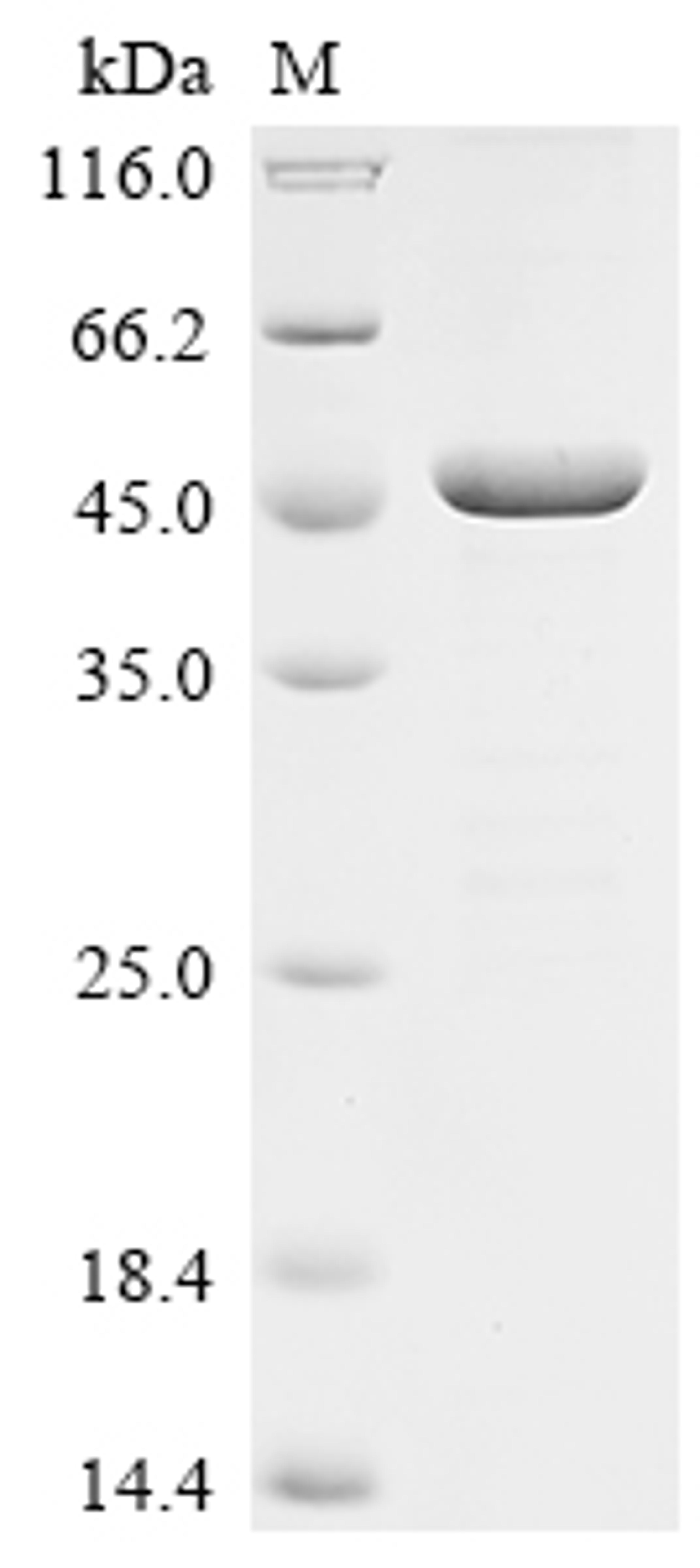 (Tris-Glycine gel) Discontinuous SDS-PAGE (reduced) with 5% enrichment gel and 15% separation gel.
