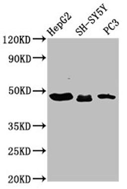 Western Blot. Positive WB detected in: HepG2 whole cell lysate, SH-SY5Y whole cell lysate, PC-3 whole cell lysate. All lanes: CXorf36 antibody at 3.9µg/ml. Secondary. Goat polyclonal to rabbit IgG at 1/50000 dilution. Predicted band size: 49, 21 kDa. Observed band size: 49 kDa